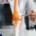 רצועות הברך תמונה מדגימה